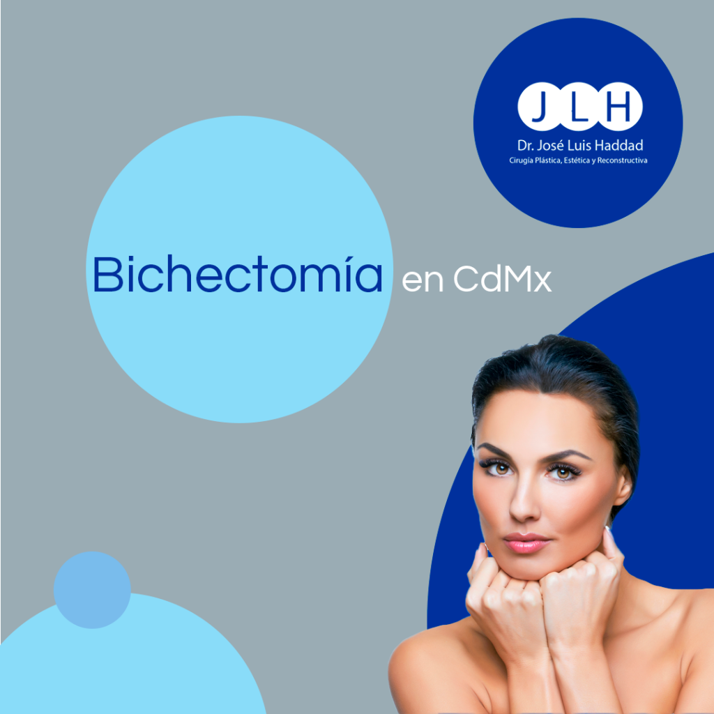 Bichectomía en CdMx